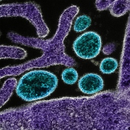 Ausbruch des Nipah-Virus, Gefährliche Zoonosen, Dengue-Fieber in Europa, Mikroplastik im Boden