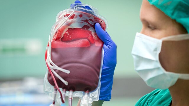 Eine Frau in OP-Kleidung hält eine Blutkonserve (durchsichtiger Beutel mit Blut) hoch.