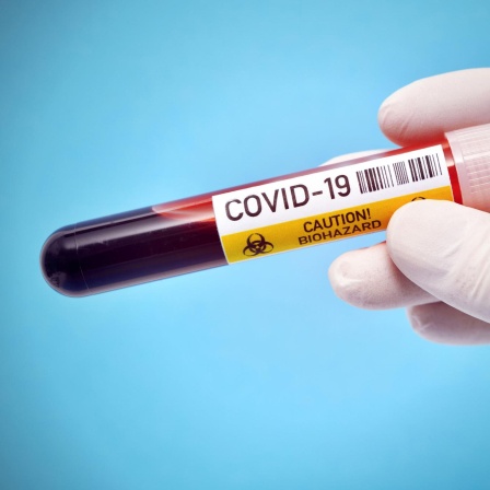 Corona-Impfstoff - Entwicklung läuft weltweit auf Hochtouren
