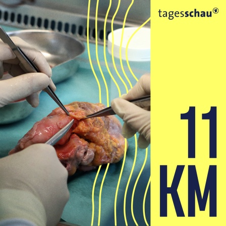 Ein Transplantationsmediziner (l), entnimmt in einer sterilen Werkbank dem Herz eines Verstorbenen die Herzklappen für eine Gewebespende.