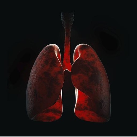 Illustration einer Lungeninfektion