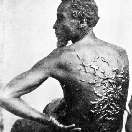Ein Schwarzer Mann zeigt seinen von Peitschenhieben vernarbten Rücken.