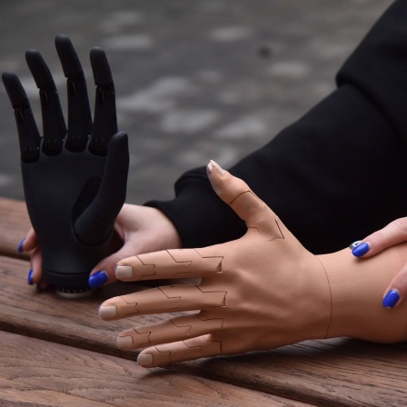 Handprothese der Firma Ottobock