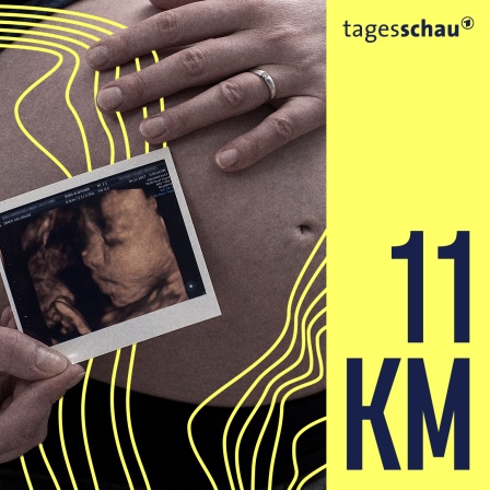 Eine schwangere Frau steht am 24.01.2018 in einer Wohnung in Bruchhausen-Vilsen (Niedersachsen) und zeigt ihr Ultraschallbild von der 3D-Ultraschalluntersuchung (gestellte Szene).