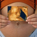 Eine schwangere Frau hält ein Ultraschallbild von ihrem Baby vor ihren Bauch.