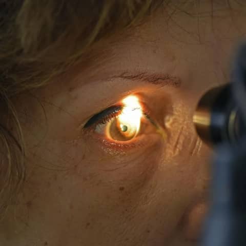 Eine Frau bei einer augenärztlichen Glaukom-Untersuchung mit einer Spaltlampe.