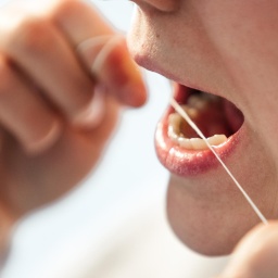 Zahnerhaltung: So bleiben die Zähne gesund