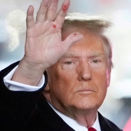 Donald Trump, Präsidentschaftskandidat und ehemaliger Präsident der USA hält eine verschmierte Hand hoch. 