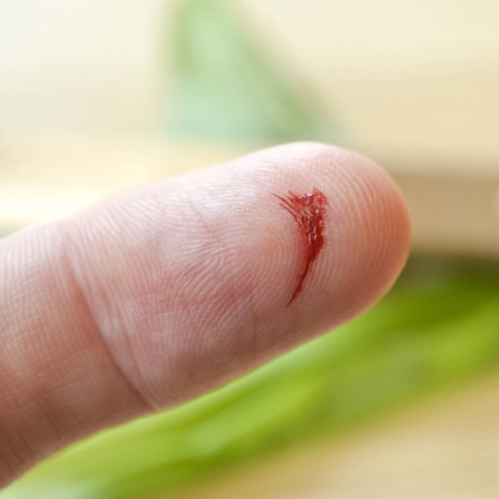 Blutender Zeigefinger: Eine Schnittwunde am Finger genügen, schon gelangen Keime in den Körper. Was harmlos beginnt, kann sich binnen Stunden zu einer tödlichen Blutvergiftung entwickeln.