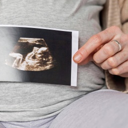 Nahaufnahme einer schwangeren Frau mit Ultraschallbild