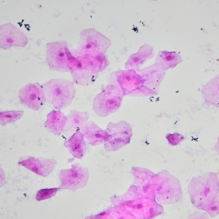Mikroskop-Aufnahme: Zellen der menschlichen Mundschleimhaut mit Bakterien (Bild: imago/CHROMORANGE)