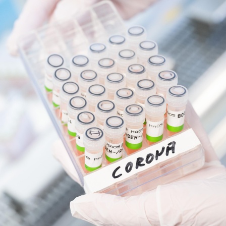 Aufbereitete PCR-Tests auf das Corona-Virus, zu sehen im PCR-Labor des Niedersächsischen Landesgesundheitsamt (NLGA).