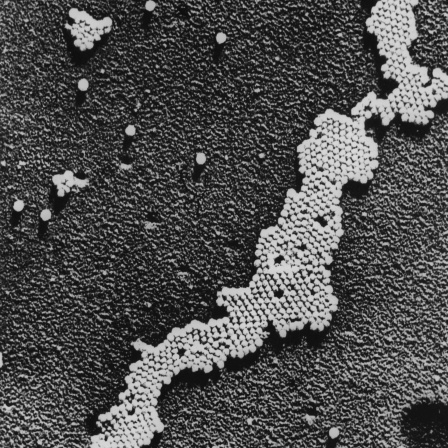 Das Poliomyelitis-Virus, die Ursache der Kinderlähmung, wurde 1908 von Karl Landsteiner entdeckt. Der Impfstoff gegen Polio wurde zwischen 1948 und 1953 entwickelt.