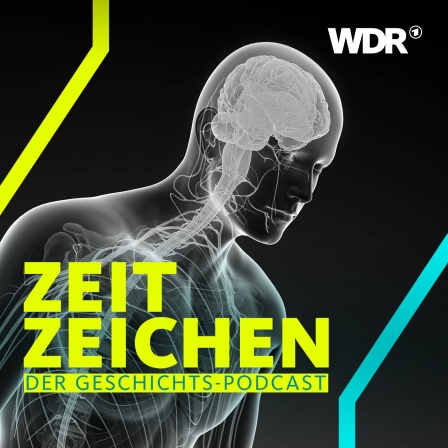 Die Parkinson-Krankheit: Veränderung im Nervensystem (Computergrafik)