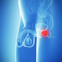 Diagnose Prostatakrebs - Mein Tumor als Rechercheobjekt