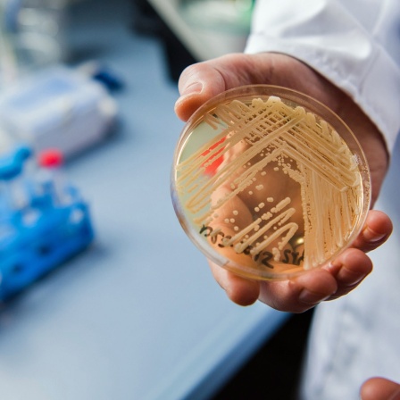 Der Leiter des Nationalen Referenzzentrums für invasive Pilzinfektionen, Oliver Kurzai, hält in einem Labor der Universität in Würzburg eine Petrischale mit dem Hefepilz Candida auris in den Händen. (Foto von 2018)