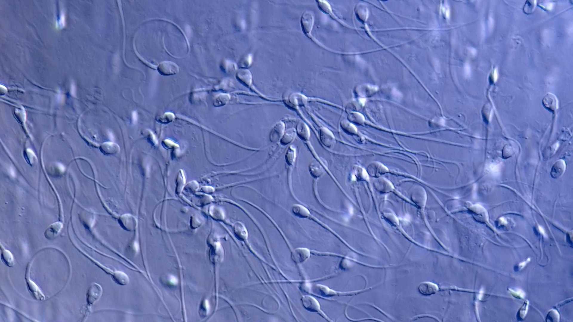 Planet Wissen: Spermien - Ist die männliche Fruchtbarkeit gefährdet? | ARD  Mediathek