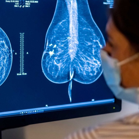 Mammografie, Untersuchung auf Brustkrebs (Bild: picture alliance/dpa)