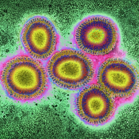 Eine Ansammlung vergrößerter und eingefärbter Grippeviren - aufgenommen mit einem Transmissionselektronenmikroskop.