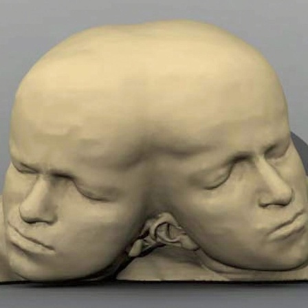 Plastik zweier zusammengewachsener Schädel mit unterschiedlichen Profilen.