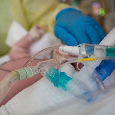 Eine Intensivpflegerin versorgt auf der Kinder-Intensivstation des Olgahospitals des Klinkums Stuttgart einen am Respiratorischen Synzytial-Virus (RS-Virus oder RSV) erkrankten Patienten, der beatmet wird
