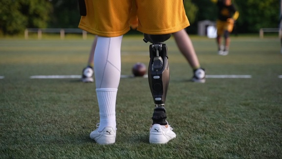 Mittagsmagazin - Cezary Lewicki Spielt Flag Football Mit Prothese