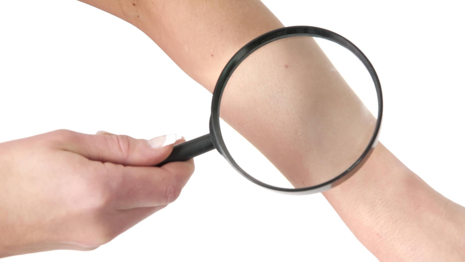 рассмотри кожу через лупу. через лупу на коже можно рассмотреть. кожа под увеличительным стеклом. кожа человека под увеличительным стеклом. планета через лупу.