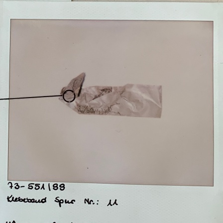 Polizeifoto eines weißen Klebebandstreifens, darunter handschriftlich: &quot;Klebeband Spur Nr.: 11&quot;