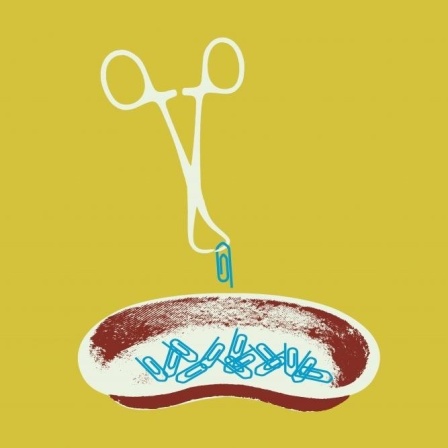 Illustration vor gelbem Hintergrund: Chirurgische Pinzette hebt Büroklammern aus einer Nierenschale.