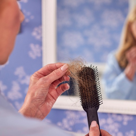 Frau mit Haarausfall