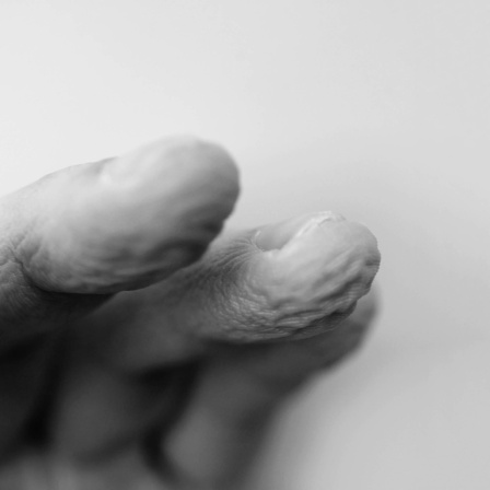 Verschrumpelte Finger in Schwarz-Weiß