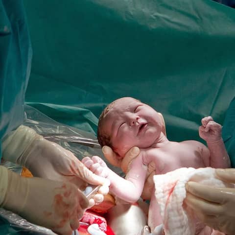 Ein Oberarzt hält im Kreißsaal ein per Kaiserschnitt zur Welt gebrachtes Mädchen in den Händen