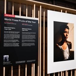 Blick auf das Gewinnerbild des World Press Photo 2025, es zeigt einen kriegsverletzten Jungen, dem beide Arme fehlen. 
