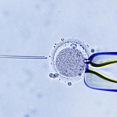 Eine Mikroskopaufnahme einer In-vitro-Fertilisation, die Injektion von Spermium in die Eizelle.