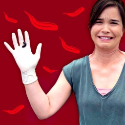 Eine Collage von Anna mit einem Blutegel auf der Hand