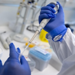 Ein Mitarbeiter pipettiert in einem Labor der Mikrobiologie der Tierärztlichen Fakultät der Ludwig-Maximilians-Universität München (LMU) bei einem Presserundgang zur Demonstration eine Flüssigkeit
