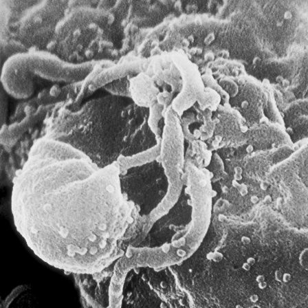 Elektronenmikroskopische Aufnahme einer von HIV infizierten Immunzelle, die viele Viruspartikel in die Umgebung abgibt (Bild: CDC | C. Goldsmith)