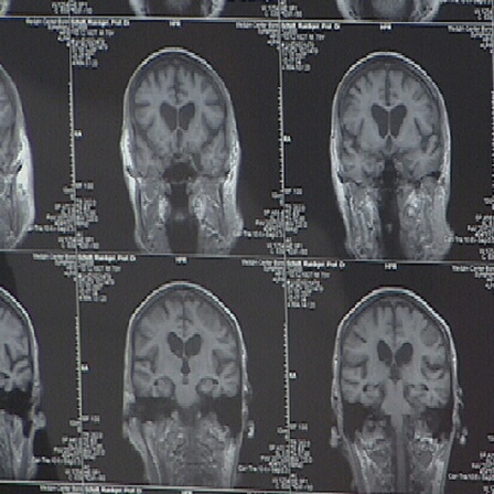 Aufnahmen eines Gehirns.