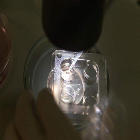30 Jahre Embryonenschutzgesetz - Von Retortenbabys, Embryonenspende und Stammzellforschung