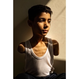 World Press Photo Award 2025: Das ausgezeichnete Foto zeigt Mahmoud Ajjour (9 Jahre), der während des Gaza-Kriegs von einer Rakete eines israelischen Kampfflugzeugs getroffen wurde und beide Arme verlor. 