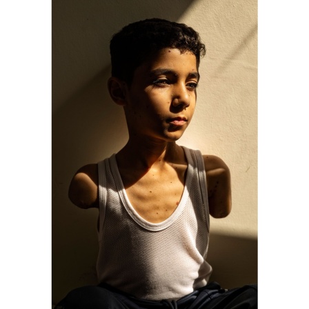 World Press Photo Award 2025: Das ausgezeichnete Foto zeigt Mahmoud Ajjour (9 Jahre), der während des Gaza-Kriegs von einer Rakete eines israelischen Kampfflugzeugs getroffen wurde und beide Arme verlor. 