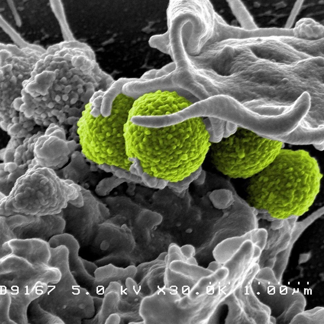 Umwelt und Verbraucher Deutschlandfunk · Bakterielle Infektionen