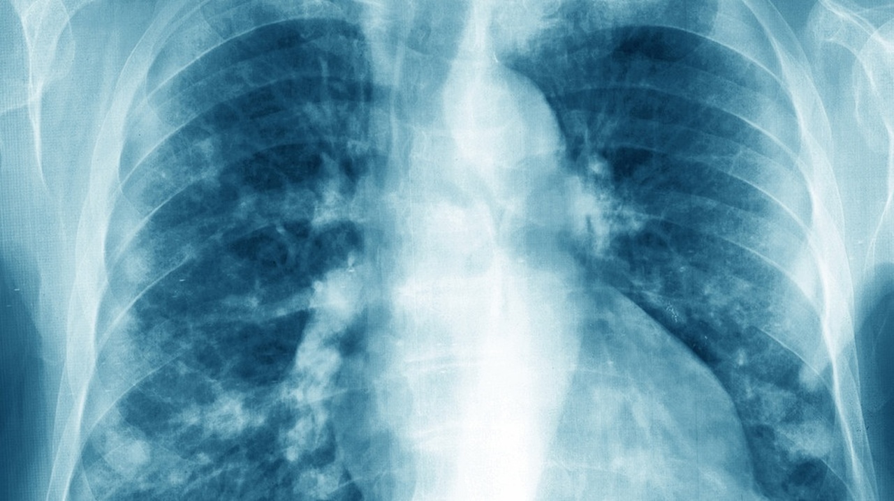 Röntgen 2.0 - Wie der Wellencharakter von Röntgenlicht die Medizinische Bildgebung verbessern wird
