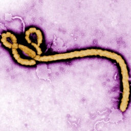 Ein Ebola-Virus unterm Mikroskop.