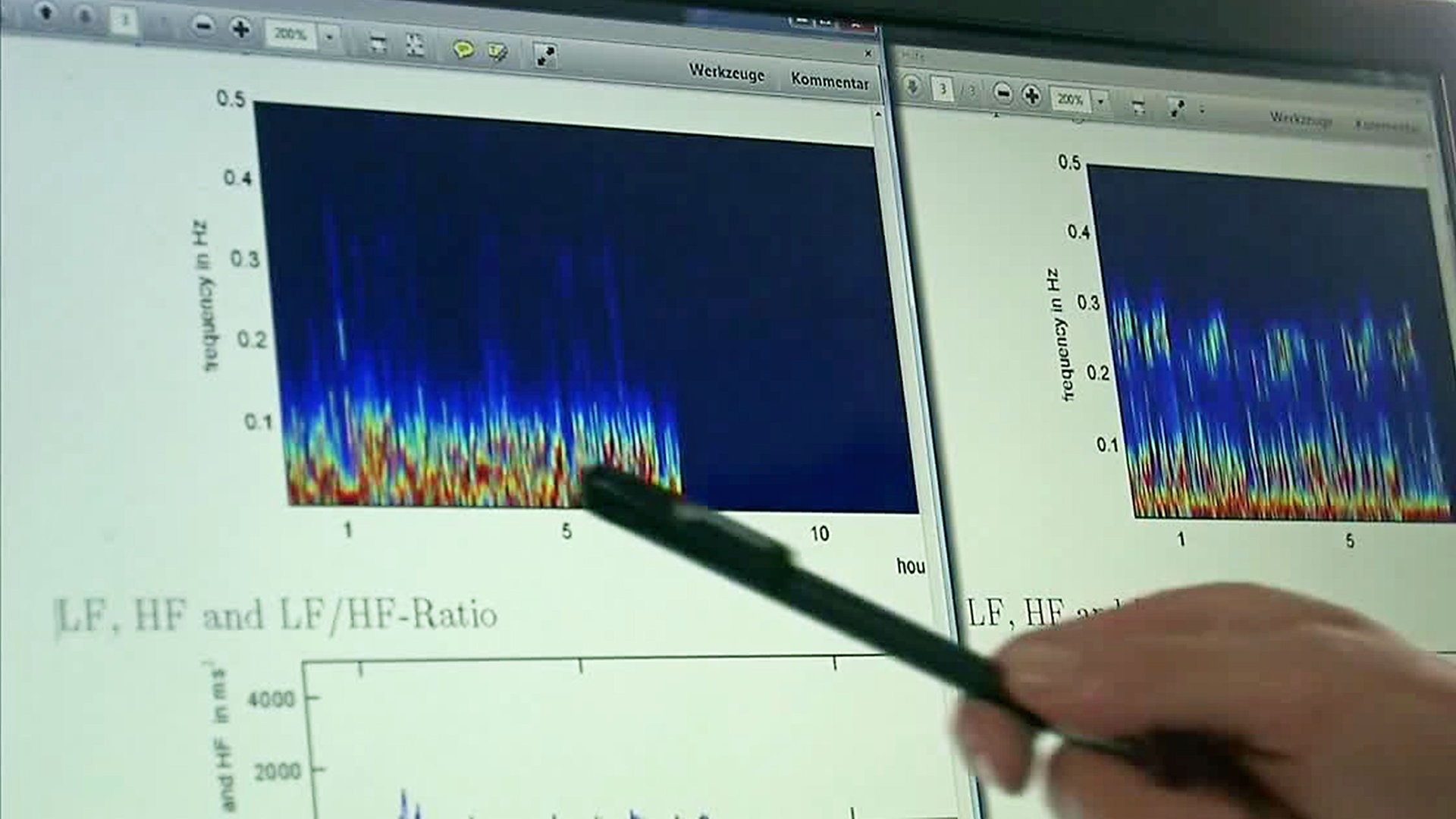 Quarks: Ein Stress-Tagebuch (Teil 1) | ARD Mediathek