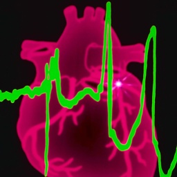 Symbolbild: EKG-Kurve vor der Grafik eines Herzens.