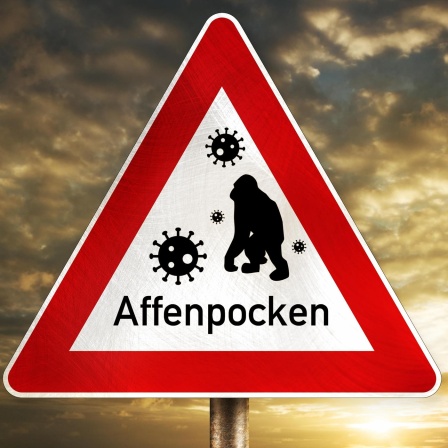 Verbreitungswege Affenpocken - Warum gerade jetzt und an so vielen Orten?