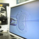 Ein Monitor zeigt in einem Kinderwunschzentrum eine Intrazytoplasmatische Spermieninjektion