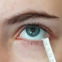 Tränenflüssigkeitstest bei Probandin mit der Pipette am Auge (nah)