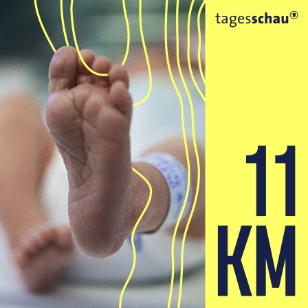 Ein zwei Tage altes Neugeborenes in einer Kinderklinik. 